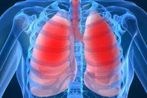 YHCT mách bạn top những bài thuốc Nam điều trị bênh viêm phổi