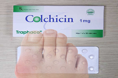 Điều trị bệnh gút bằng thuốc Colchicin