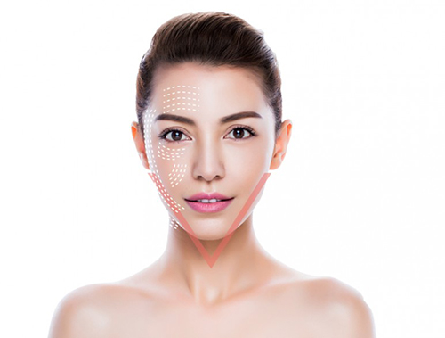 Căng da mặt nội soi là phương pháp mà nhiều chị em lựa chọn<center/><em/>