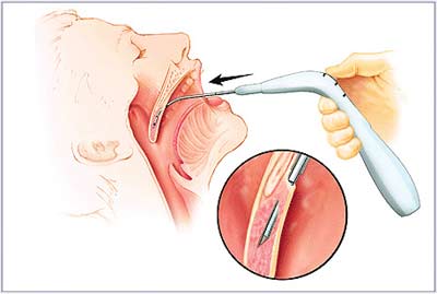 Sử dụng thuốc tai - mũi - họng như thế nào để đảm bảo an toàn?